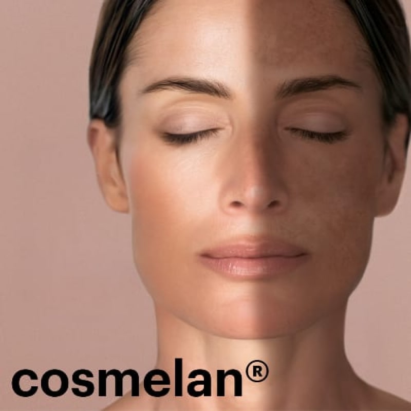 cosmelan® professionelle intensive Depigmentierungsbehandlung